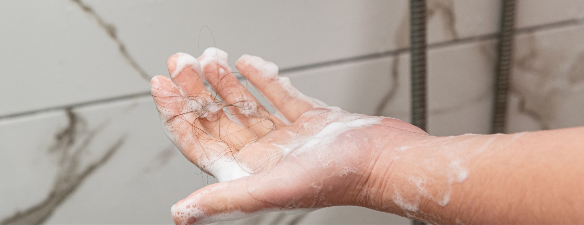 Queda de cabelo na mudança de estação: mito ou realidade?